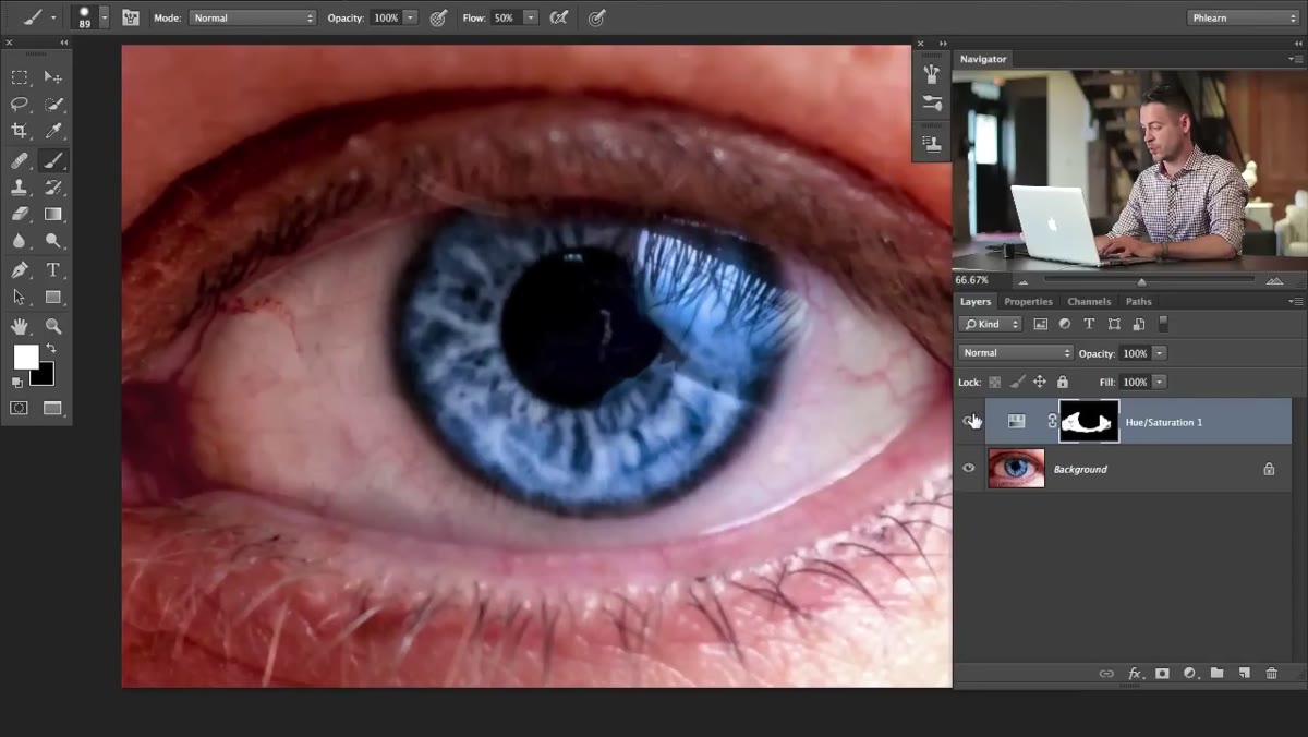 Before and after comparison of eye with reduced redness